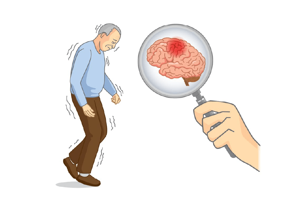 Dra. Sunilda Vassallo 10 (Trastorno Del movimiento)